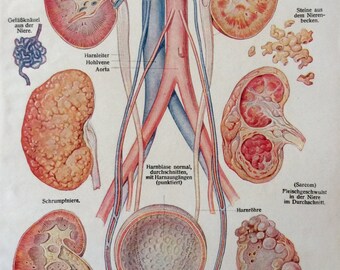Vintage 1920s German Medical Anatomy Kidney Disease Organ Diagram Bookplate