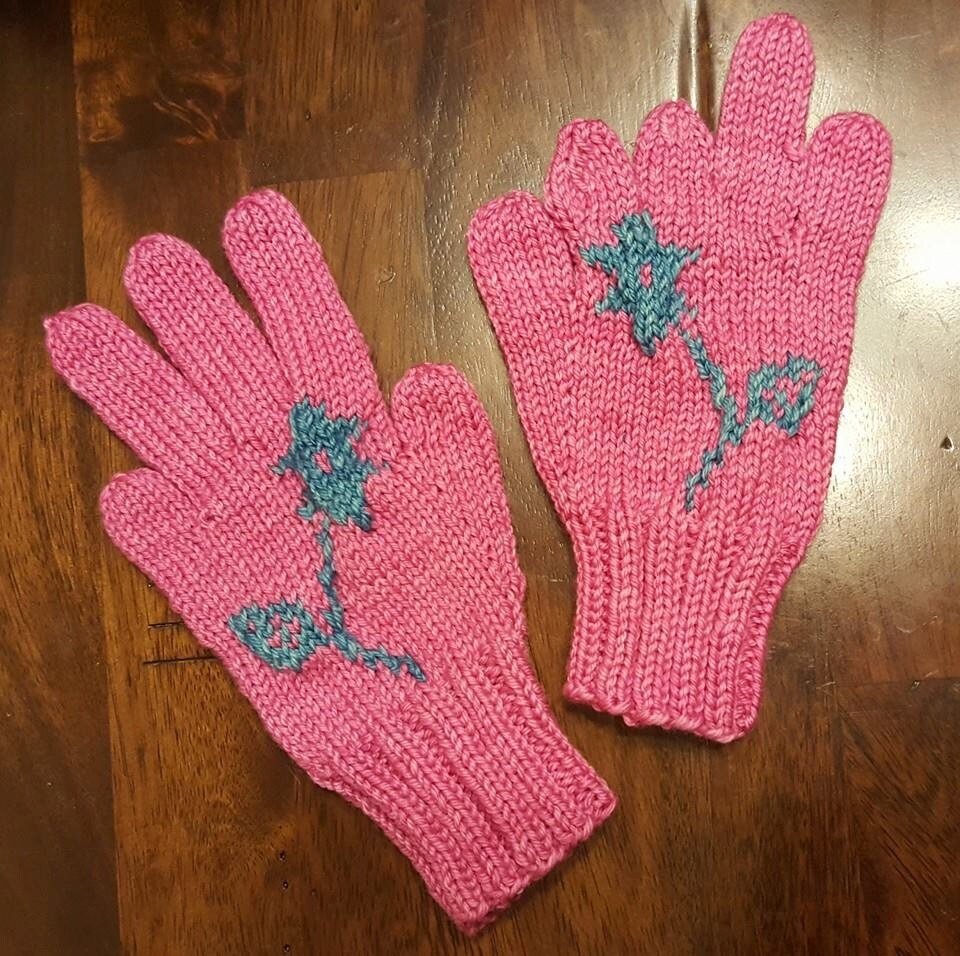 Custom Made Gloves For People With Congenial Hand Defects Or