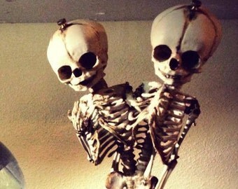 SALE Conjoined Twins Siamese Fetal Skeletons