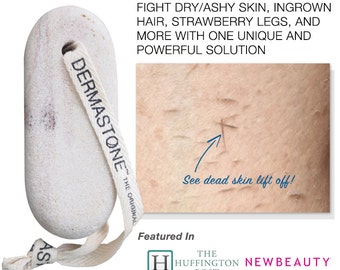 Dermastone Leg & Body Scrub - Natural stone exfoliator - Treatment for dry ashy skin, dull rough skin, ingrown hair, and strawberry legs