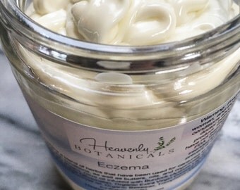 Eczema cream, Psoriasis lotion, Dry skin cream, organic ingredients, Cocoa butter, burdock, plantain, calendula, Coconut oil, organic lotion