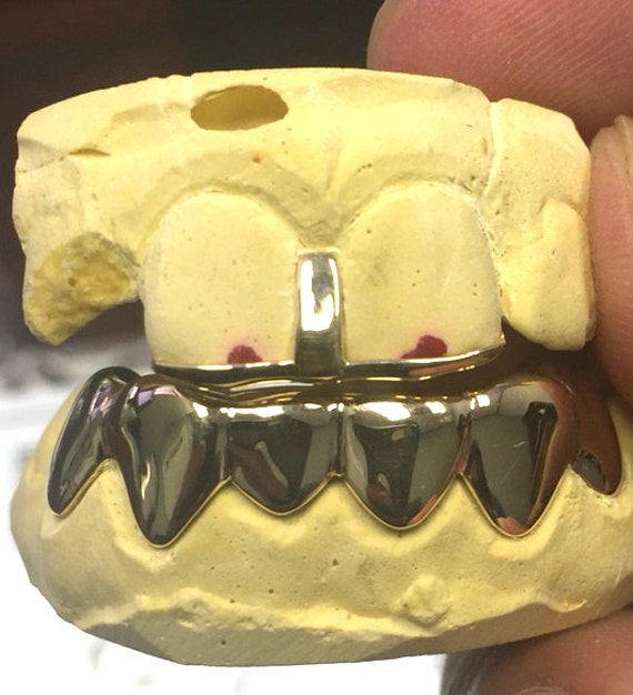 Custom Middle Gap Bar Grillz & 6 Bottom SET 10k Gold Grillz