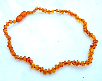Baltic Amber Baby Teething Necklace Honey Natural Healing