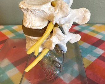Vintage Western Germany Made Somso Medical Model Intervertebral Disc