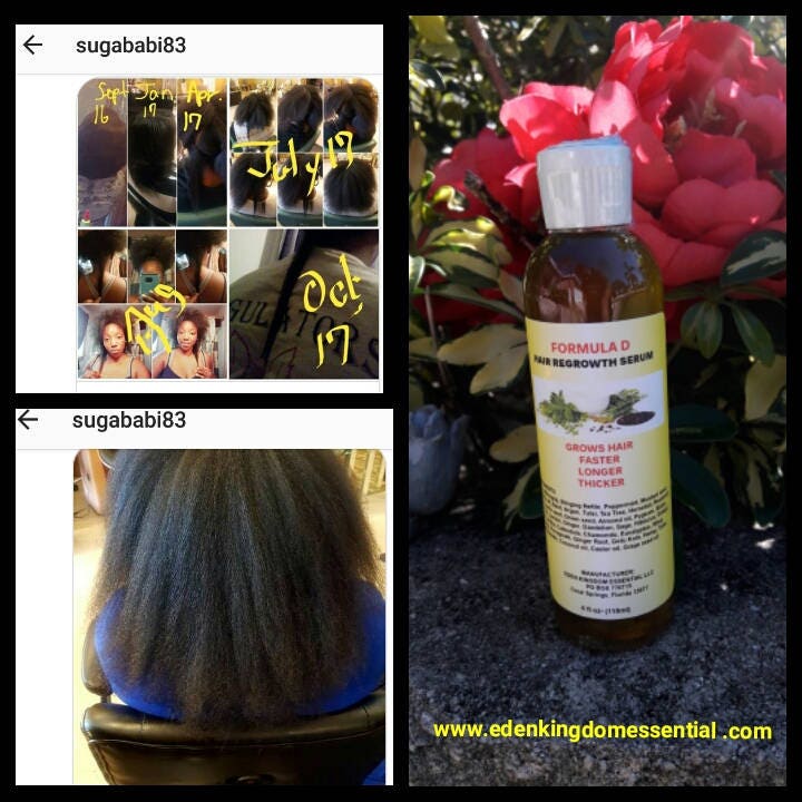 Formula D Hair Growth Serum, Amla, Bhringraj Coconut Oil ...