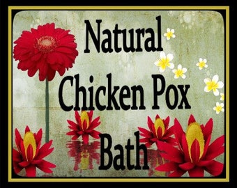 Items similar to Chicken Pox on Etsy